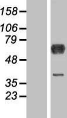 Western Blot: DYNC1LI1 Overexpression Lysate (Adult Normal) [NBP2-07086] Left-Empty vector transfected control cell lysate (HEK293 cell lysate); Right -Over-expression Lysate for DYNC1LI1.