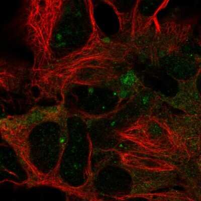 Immunocytochemistry/Immunofluorescence: DYNC1LI2 Antibody [NBP2-58088] - Staining of human cell line HEK 293 shows localization to centrosome.