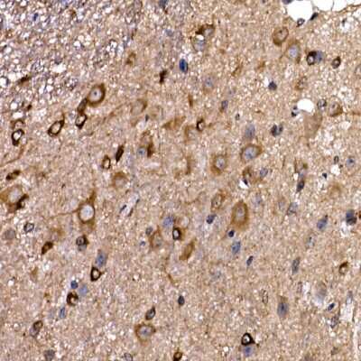 Immunohistochemistry-Paraffin: DYNC1LI2 Antibody [NBP3-16056] - Immunohistochemistry of paraffin-embedded mouse spinal cord using DYNC1LI2 Rabbit pAb (NBP3-16056) at dilution of 1:25 (40x lens).Perform high pressure antigen retrieval with 10 mM citrate buffer pH 6.0 before commencing with IHC staining protocol.