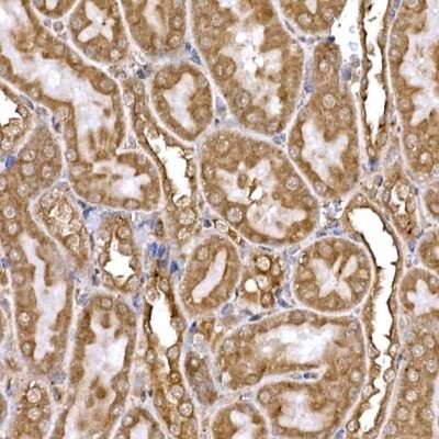 Immunohistochemistry-Paraffin: DYNC1LI2 Antibody [NBP3-16056] - Immunohistochemistry of paraffin-embedded rat kidney using DYNC1LI2 Rabbit pAb (NBP3-16056) at dilution of 1:25 (40x lens).Perform high pressure antigen retrieval with 10 mM citrate buffer pH 6.0 before commencing with IHC staining protocol.