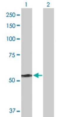 Western Blot: DYNC1LI2 Antibody [H00001783-D01P] - Analysis of DYNC1LI2 expression in transfected 293T cell line by DYNC1LI2 polyclonal antibody.Lane 1: DYNC1LI2 transfected lysate(54.10 KDa).Lane 2: Non-transfected lysate.