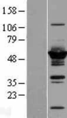 Western Blot DYNC1LI2 Overexpression Lysate