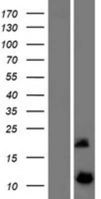 Western Blot DYNLRB2 Overexpression Lysate