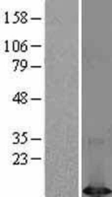 Western Blot: DYNLT1 Overexpression Lysate (Adult Normal) [NBL1-10073] Left-Empty vector transfected control cell lysate (HEK293 cell lysate); Right -Over-expression Lysate for DYNLT1.