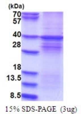 SDS-Page: Recombinant Human DYRK1A Protein [NBP2-51732] -  15% SDS Page (3 ug)