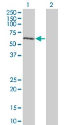 Western Blot: DYRK2 Antibody (4G11) [H00008445-M03] - Analysis of DYRK2 expression in transfected 293T cell line by DYRK2 monoclonal antibody (M03), clone 4G11. Lane 1: DYRK2 transfected lysatE (59.72 KDa). Lane 2: Non-transfected lysate.