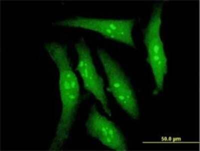 Immunocytochemistry/Immunofluorescence: DYRK2 Antibody (6E2) [H00008445-M02] - Analysis of monoclonal antibody to DYRK2 on HeLa cell . Antibody concentration 10 ug/ml.