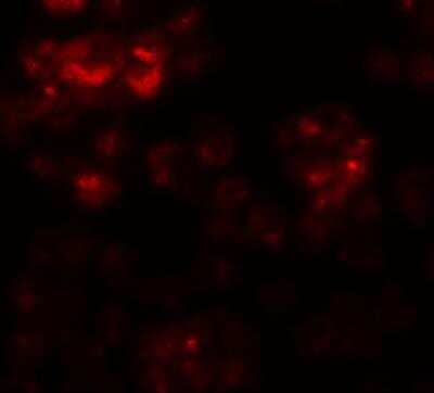 Immunocytochemistry/Immunofluorescence: DYRK2 Antibody [NBP1-76560] - Immunofluorescence of DYRK2 in 293 cells with DYRK2 antibody at 20 ug/mL.