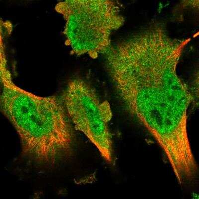 Immunocytochemistry/Immunofluorescence: DYRK2 Antibody [NBP1-89516] - Staining of human cell line U-251 MG shows localization to nucleoplasm & cytosol. Antibody staining is shown in green.