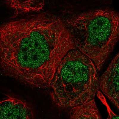 Immunocytochemistry/Immunofluorescence: DYRK2 Antibody [NBP2-58747] - Staining of human cell line A-431 shows localization to nucleoplasm.