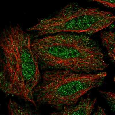 Immunocytochemistry/Immunofluorescence: DYRK3 Antibody [NBP2-57912] - Staining of human cell line SiHa shows localization to nucleoplasm & cytosol.