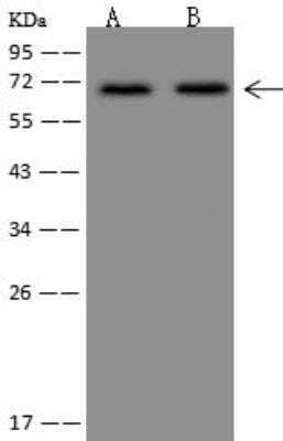 Western Blot: DYRK3 Antibody [NBP3-12695] - Lane A: Jurkat Whole Cell LysateLane B: HeLa Whole Cell LysateLysates/proteins at 30 ug per lane.SecondaryGoat Anti-Rabbit IgG (H+L)/HRP at 1/10000 dilution.Developed using the ECL technique.Performed under reducing conditions.Predicted band size:66 kDaObserved band size:66 kDa