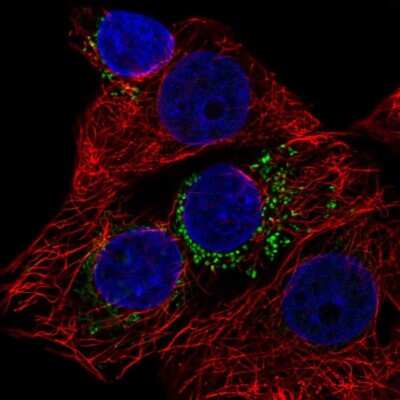 <b>Independent Antibodies Validation. </b>Immunocytochemistry/Immunofluorescence: DYRK4 Antibody [NBP2-38781] - Immunofluorescent staining of human cell line MCF7 shows localization to vesicles.