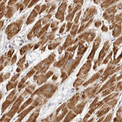 Immunohistochemistry-Paraffin: DYRK4 Antibody [NBP1-89511] - Staining of human heart muscle shows strong cytoplasmic positivity in myocytes.