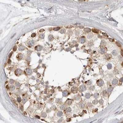 Immunohistochemistry-Paraffin: DYRK4 Antibody [NBP1-89511] - Staining of human testis.