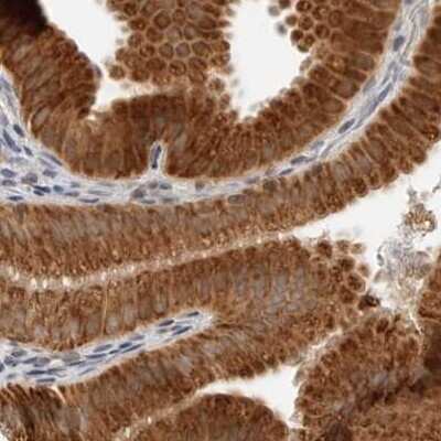 Immunohistochemistry-Paraffin: DYRK4 Antibody [NBP1-89511] - Staining of human gallbladder.