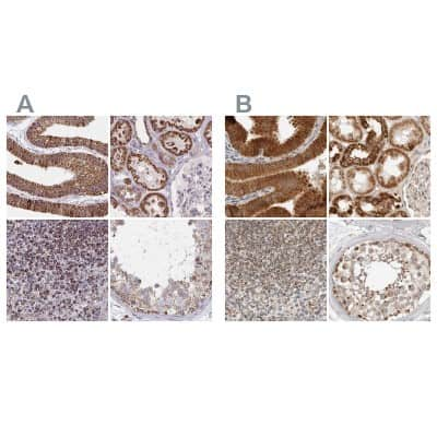 Immunohistochemistry-Paraffin DYRK4 Antibody