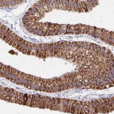 Immunohistochemistry-Paraffin: DYRK4 Antibody [NBP2-38781] - Staining of human gallbladder.