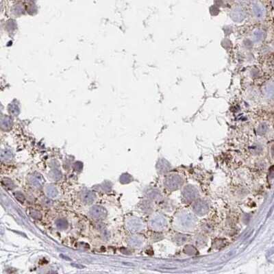 Immunohistochemistry-Paraffin: DYRK4 Antibody [NBP2-38781] - Staining of human testis.