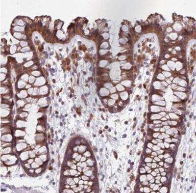 Immunohistochemistry-Paraffin DYSFIP1 Antibody - BSA Free