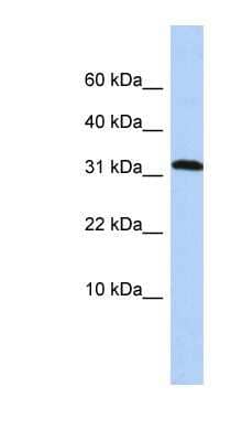 Western Blot: DYSFIP1 Antibody [NBP1-55525] - HepG2 cell lysate, concentration 0.2-1 ug/ml.