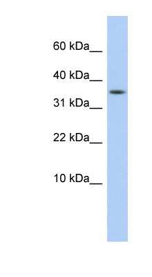 Western Blot DYSFIP1 Antibody - BSA Free