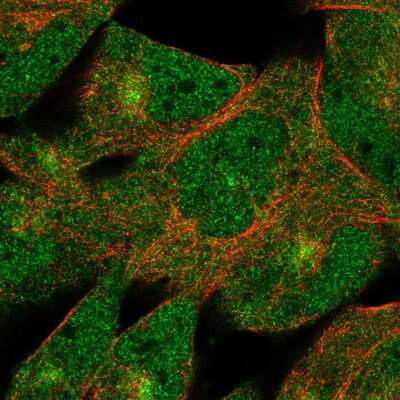 Immunocytochemistry/Immunofluorescence: DZIP1 Antibody [NBP2-55917] - Staining of human cell line RH-30 shows localization to nucleoplasm, cytosol & microtubule organizing center.