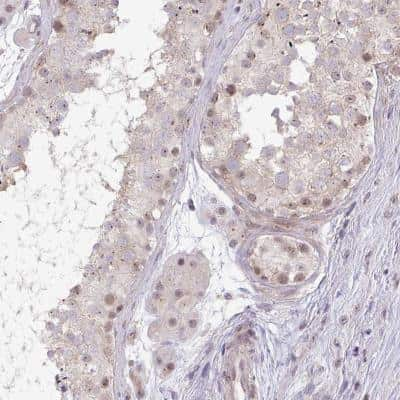 Immunohistochemistry-Paraffin: DZIP1 Antibody [NBP2-31669] - Staining of human testis shows weak nuclear and cytoplasmic positivity in cells in seminiferus ducts.