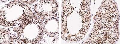 Immunohistochemistry-Paraffin: DZIP1 Antibody [NBP2-98687] - Immunochemical staining of human DZIP1 in human testis (from 2 donors) with rabbit polyclonal antibody (1:2000, formalin-fixed paraffin embedded sections).