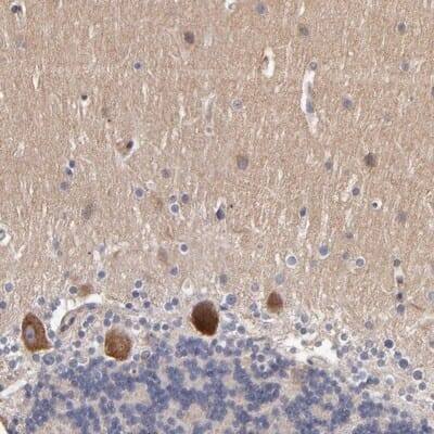 Immunohistochemistry-Paraffin: Dact1 Antibody [NBP1-85308] - Staining of human cerebellum shows strong cytoplasmic positivity in Purkinje cells.