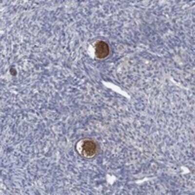 Immunohistochemistry-Paraffin: Dact1 Antibody [NBP3-17785] - Staining of human ovary shows strong positivity in follicle cells.