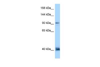 Western Blot: Dact1 Antibody [NBP2-84757] - WB Suggested Anti-DACT1 Antibody. Titration: 1.0 ug/ml. Positive Control: MDA-MB-435S Whole Cell