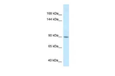 Western Blot: Dact1 Antibody [NBP2-84758] - WB Suggested Anti-DACT1 Antibody. Titration: 1.0 ug/ml. Positive Control: 293T Whole Cell