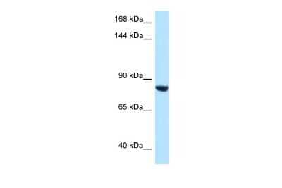 Western Blot: Dact1 Antibody [NBP2-84759] - WB Suggested Anti-DACT1 Antibody. Titration: 1.0 ug/ml. Positive Control: HepG2 Whole Cell