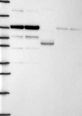 Western Blot: Dact1 Antibody [NBP3-17785] - Lane 1: Marker [kDa] 250, 130, 95, 72, 55, 36, 28, 17, 10;   Lane 2: RT4;   Lane 3: U-251 MG;   Lane 4: Human Plasma;   Lane 5: Liver;   Lane 6: Tonsil