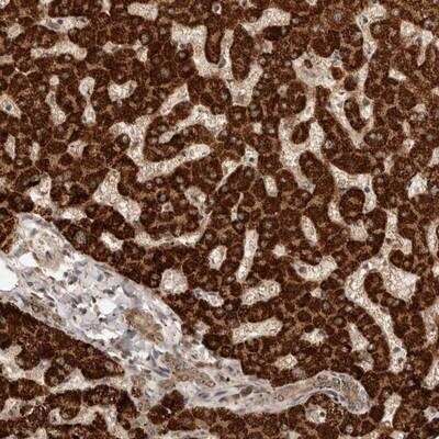 Immunohistochemistry: Dact2 Antibody [NBP1-88755] - Staining of human liver shows strong granular cytoplasmic positivity in hepatocytes.