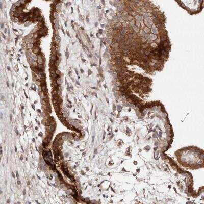 Immunohistochemistry-Paraffin: Dact2 Antibody [NBP1-88756] - staining of human placenta shows cytoplasmic positivity in trophoblastic cells.