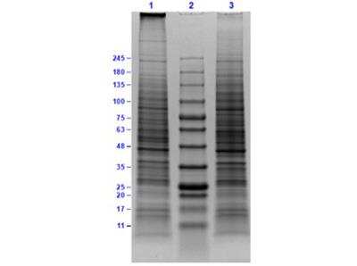 SDS-PAGE Daudi Whole Cell Lysate