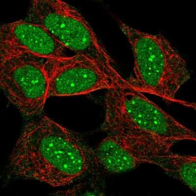 Immunocytochemistry/Immunofluorescence: Daxx Antibody [NBP2-56390] - Staining of human cell line SH-SY5Y shows localization to nucleus & nuclear bodies. Antibody staining is shown in green.