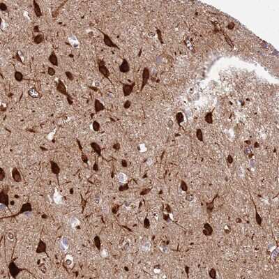 Immunohistochemistry-Paraffin: DcR3 Antibody [NBP2-13460] Staining of human cerebral cortex shows strong cytoplasmic positivity in neuronal and glial cells.