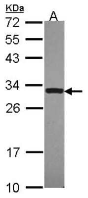 Western Blot: DcR3 Antibody [NBP2-16112] - Sample (30 ug of whole cell lysate) A: JurKat 12% SDS PAGE gel, diluted at 1:1000.
