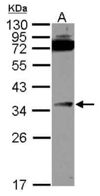 Western Blot: DcR3 Antibody [NBP2-16113] - Sample (30 ug of whole cell lysate) A: HCT116 12% SDS PAGE gel, diluted at 1:1000.