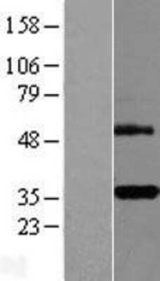 Western Blot: DcR3 Overexpression Lysate (Adult Normal) [NBL1-17158] Left-Empty vector transfected control cell lysate (HEK293 cell lysate); Right -Over-expression Lysate for DcR3.