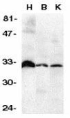 Western Blot: DcR3/TNFRSF6B Antibody [NBP1-76909] - Analysis of DcR3 in human heart (H), brain (B), and kidney (K) tissue lysates with anti-DcR3 (NT) using NBP1-76909 at 1:500 dilution.