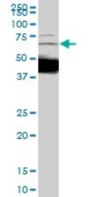 Western Blot: Dcp1a Antibody (2D12) [H00055802-M01] - DCP1A monoclonal antibody (M01), clone 2D12. Analysis of DCP1A expression in IMR-32.