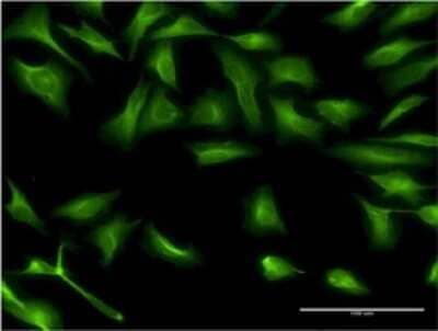 Immunocytochemistry/Immunofluorescence: Dcp1a Antibody (2F11) [H00055802-M02] - Analysis of monoclonal antibody to DCP1A on HeLa cell . Antibody concentration 10 ug/ml.