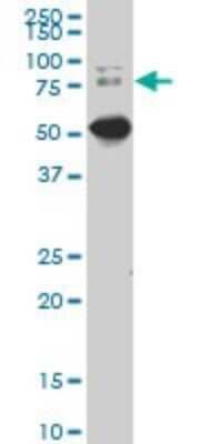 Western Blot: Dcp1a Antibody (2F11) [H00055802-M02] - DCP1A monoclonal antibody (M02), clone 2F11. Analysis of DCP1A expression in IMR-32.