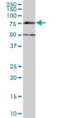 Western Blot: Dcp1a Antibody (2G10) [H00055802-M07] - Analysis of DCP1A expression in IMR-32 (Cat # L008V1).