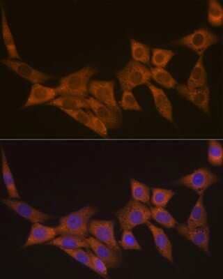 Immunocytochemistry/Immunofluorescence: Dcp1a Antibody (7Q8Q6) [NBP3-16644] - Immunofluorescence analysis of NIH-3T3 cells using Dcp1a Rabbit mAb (NBP3-16644) at dilution of 1:100 (40x lens). Blue: DAPI for nuclear staining.