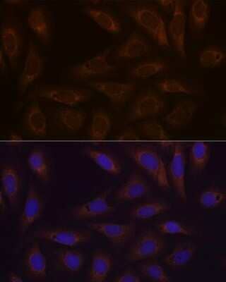 Immunocytochemistry/Immunofluorescence: Dcp1a Antibody (7Q8Q6) [NBP3-16644] - Immunofluorescence analysis of U-2 OS cells using Dcp1a Rabbit mAb (NBP3-16644) at dilution of 1:100 (40x lens). Blue: DAPI for nuclear staining.